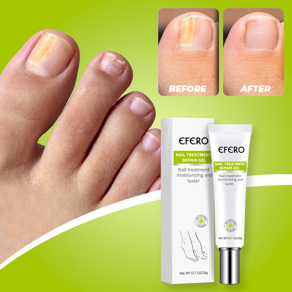 Gel Réparateur pour les Ongles